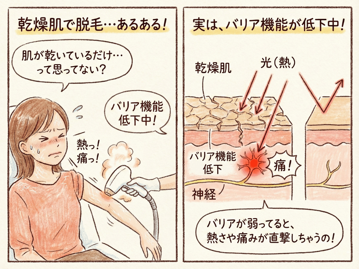 なぜ「乾燥肌」だと脱毛によくないの？